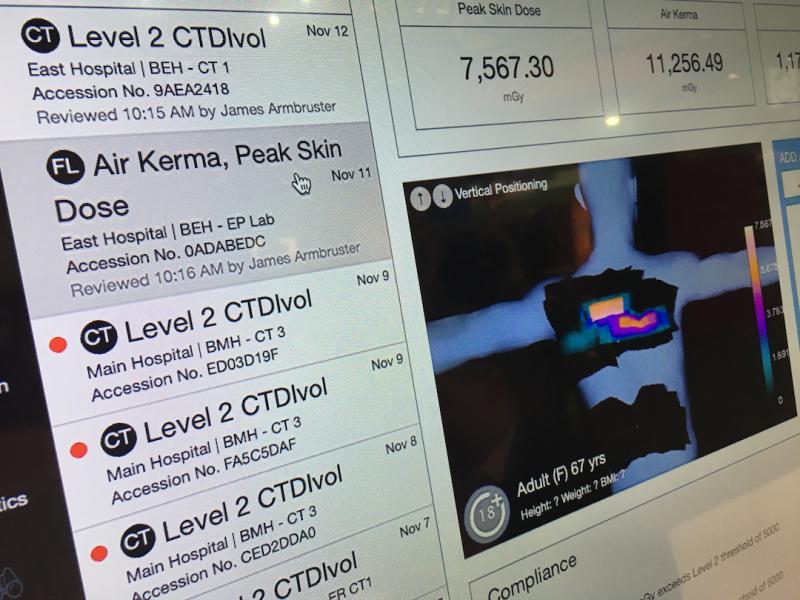 An example of radiation dose tracking software from Imalogix showing data on cath lab angiography cases at RSNA 2019. Photo by Dave Fornell