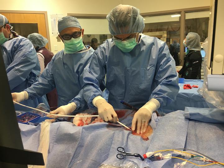 Tufts Medical Center created a heart failure team approach to care for its patients. The program includes an interventional heart failure fellowship program, where interventional cardiologists learn more advanced care, as show here with an ECMO procedure being performed in a cath lab at Tufts. The interventional cardiologists learn how to better care for heart failure patients and interface with surgeons, intensivists and others on the HF care team. The operator is Nevin Kapur. Photo by Dave Fornell.