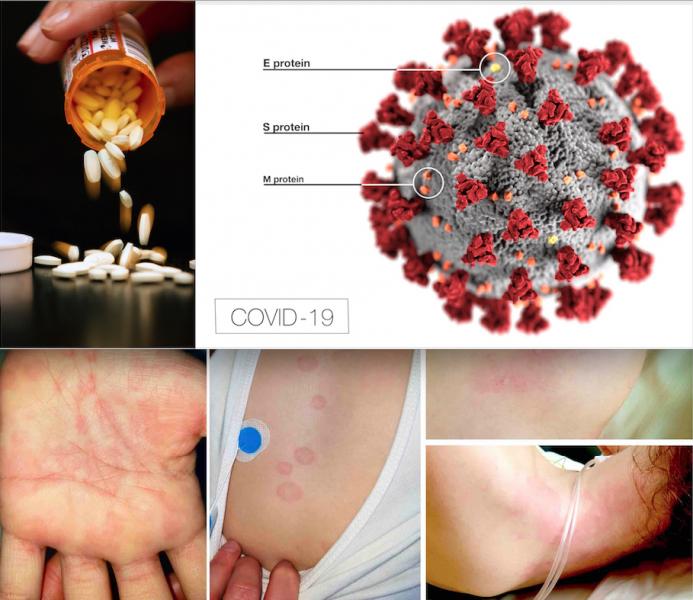 All coronavirus content continued as the most popular content in May 2020. Two of the major topics included an article on the new Kawasaki-like inflammatory disease that affects children with COVID-19 and articles and videos on the cardiovascular effects of hydroxychloroquine in treating or preventing COVID. #COVID19 #SARScov2