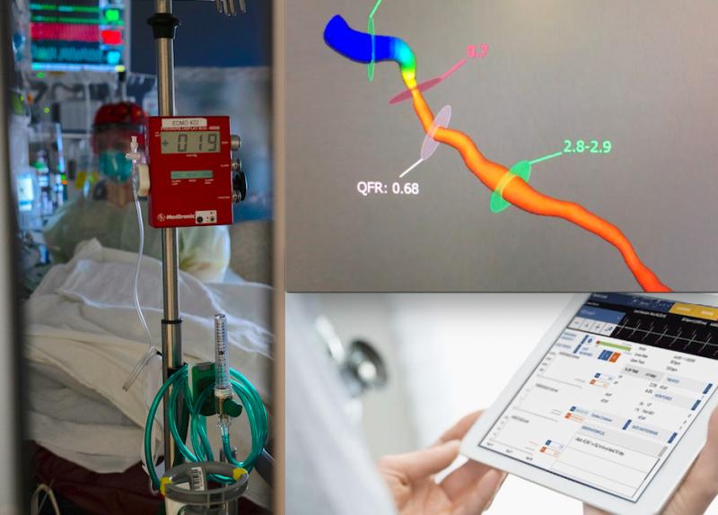 The most popular videos in 2021 included the use of ECMO for COVID-19 patients, a demonstration of the Medis QFR angiography image derived FFR system, and the use of remote EP monitoring systems.