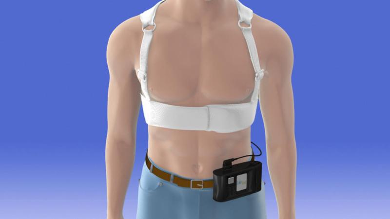 The Zoll LifeVest wearable defibrillator was the subject of the VEST Trial