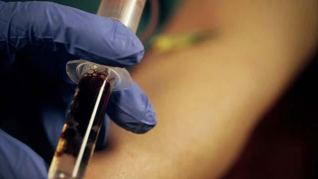 FDA Clears Abbott's High Sensitivity Troponin-I Blood Test