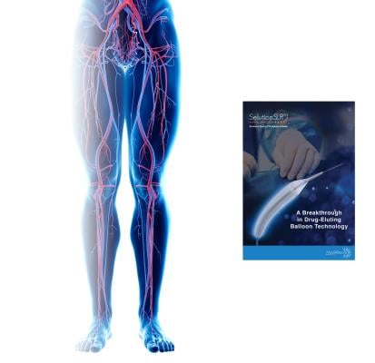 SELUTION SLR, MedAlliance’s novel sirolimus-eluting balloon, has received FDA Investigational Device Exemption (IDE) approval to initiate its coronary pivotal clinical trial.  