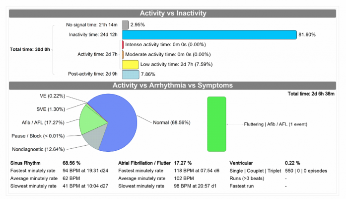 An example of an automated summary cardiac monitor report from Medicalgorithmics' PocketECG system. Most of the the report parameters can be opened as separate pages with additional automated report summaries and graphical data charts. 