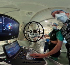 This shows the TEE ultrasound imaging used to guide MitraClip procedures to treat functional mitral regurgitation.