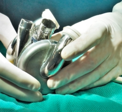 Artificial Heart Receives Breakthrough Device Designation from FDA