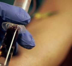 More Sensitive Blood Test Diagnoses Heart Attacks Faster