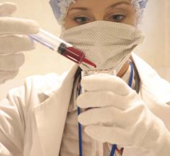Study Shows Multiple Benefits of Patient-to-Patient Connectivity in Familial Chylomicronemia Syndrome