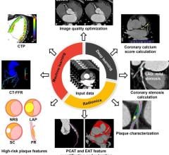 The application of AI technology in the diagnosis of cardiovascular diseases using coronary CT angiography (CCTA) has gradually deepened