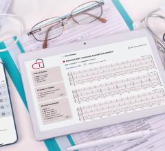 Camgenium, Cardiac Tech Partner to Improve Patient Outcomes  Post-Cardiac Surgery