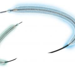 Concept Medical Inc. Granted Breakthrough Device Designation for MagicTouch Sirolimus Coated Balloon