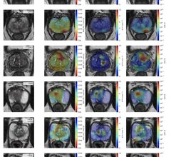 A University of Waterloo engineer’s MRI invention reveals better than many existing imaging technologies how COVID-19 can change the human brain. 