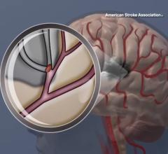 The results come from a national study of more than 1 million U.S. hospital admissions among young adult tobacco users without other known cardiovascular risk factors