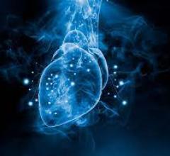 Core Sound Imaging, Inc. has announced it will preview its new Studycast Integration Program during the 34th Annual Scientific Sessions of the American Society of Echocardiography (ASE2023), to be held June 23-26 in National Harbor, MD.