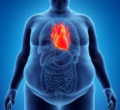 A newly-published study in the European Society of Cardiology’s European Heart Journal is shedding new light on the obesity paradox.