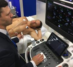 The World Alliance of Societies of Echocardiography (WASE) Normal Values Study is a cross-sectional study designed to obtain universal global reference ranges for both 2-D and 3-D echocardiographic (2DE, 3DE) data to identify geographical differences in echocardiographic measurements. Launched in 2016, the WASE study prospectively enrolled healthy individuals free from cardiac, lung, and kidney disease from 19 centers in 15 countries. #ASE #ASE2020