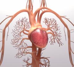 Represents the third patent granted to Tenax since March of 2023 protecting the use of levosimendan in the treatment of PH-HFpEF