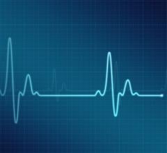 Supira's technology features a novel low profile, high continuous flow design that aims to provide full hemodynamic support for high-risk percutaneous coronary interventions (HRPCI) and cardiogenic shock (CS) patients with a single device 