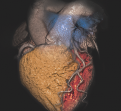 AI Visualize Inc. Debuts Artificial Intelligence Cloud Image Visualization Platform at RSNA 2017