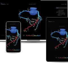 Using coronary computed tomography angiography (CCTA) with HeartFlow’s FFRCT Analysis to evaluate suspected coronary artery disease (CAD) offers more accurate non-invasive diagnosis, fewer unnecessary tests, and higher confidence in identifying patients needing treatment 