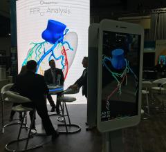 HeartFlow Analysis Successfully Stratifies Heart Disease Patients at One Year