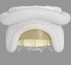 Edwards Lifesciences identified the top data releases from 2022 that contributed most to shaping awareness about the extent and impact of underdiagnosis and undertreatment of aortic stenosis (AS). 
