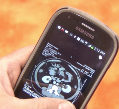 Survey Finds Personalized Patient Engagement Improving But Still Lacking