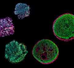 TUM team develops first heart organoid containing cardiac muscle cells and outer layer of the heart wall 