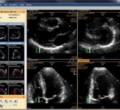 NewYork-Presbyterian Hospital Partners With Philips for Health IT and Clinical Informatics