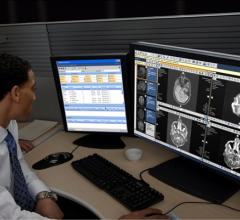Philips Warns of Cybersecurity Vulnerabilities in IntelliSpace and iSite PACS Products