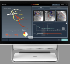 Machine learning can be used to help clinicians with early diagnosis 