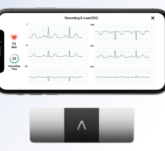 Pilot study will assess positive impacts of real-time safety monitoring on patient outcomes and treatment experience 