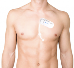 SmartCardia has received FDA clearance for its 7-lead real-time ECG monitoring patch and cloud platform