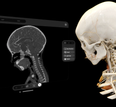 Cinematic Reality app enables interaction with realistic renderings of human anatomy