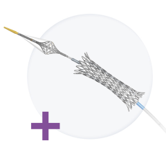 The non-surgical device prevents dangerous plaque buildup in neck arteries from cutting off oxygen to the brain
