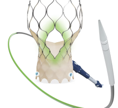 Late-breaking data included a SMART Trial secondary analysis showing significantly less bioprosthetic valve dysfunction with Evolut TAV across the entire range of small annulus areas when compared with the Edwards Sapien 3 TAV platform