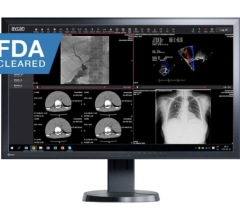 aycan now offers AI solution for cardiology, enabling further expansion into that market and the growing medical AI solution space