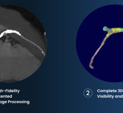 Multi-center, Retrospective Trial to Assess Prognostic Accuracy of Elucid’s Plaque and Plaque-based FFRCT Software in Patients with Clinically Indicated CCTA