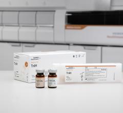 Siemen's Atellica IM high-sensitivity troponin I assay (TnIH).