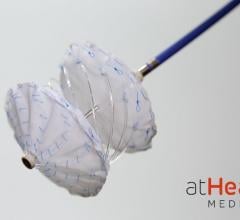 The reSept ASD Occluder is the first structural heart occluder with a metal-free, bioresorbable frame. The novel implant is designed to overcome the limitations of current transcatheter occluders. It is hoped the design will reduce the risk of complications associated with the long-term presence of metal in the heart and to preserve future treatment options requiring transseptal intervention.