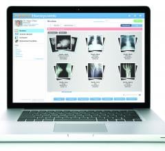IBM, purchase, Merge Healthcare, $1 billion, Watson