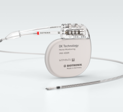 In combination with BIOTRONIK Home Monitoring the DX ICD system is an effective and convenient way to detect AHRE and monitor atrial fibrillation events and burden 