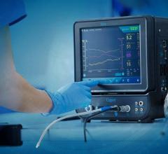 Increasing prevalence of cardiovascular, COPD and respiratory diseases; development of next-generation non-invasive and minimally-invasive systems 