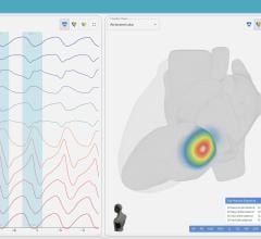Updated AI-based software is designed to improve cardiac ablation outcomes and procedural efficiencies 
